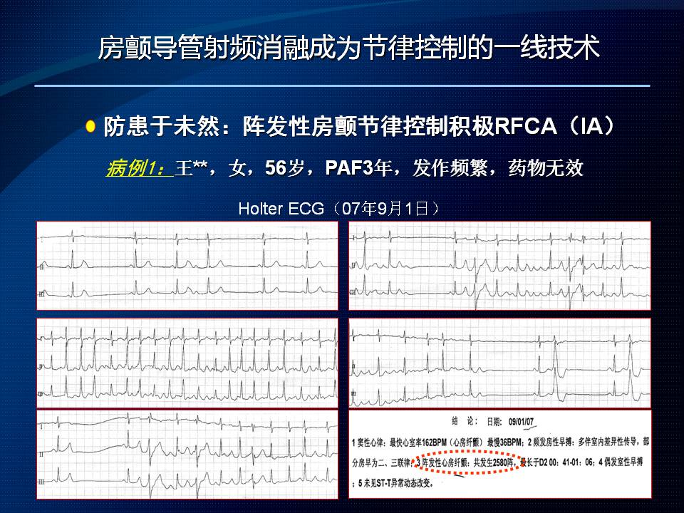 房颤吧最新资讯,全面指南助你应对房颤挑战