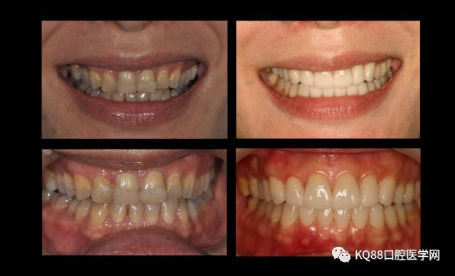 颌学最新旅行指南,探索自然美景,寻觅内心宁静之旅